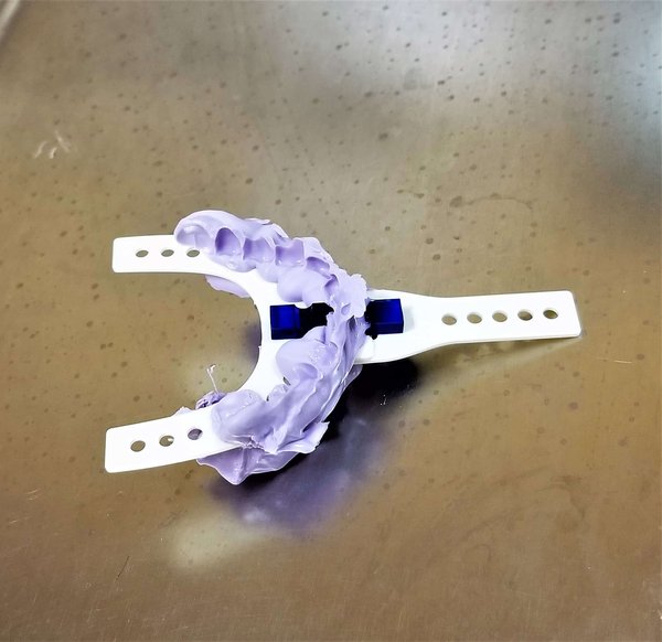 La clinique Prisma propose-t-elle des soins pour les dents de sagesse ?